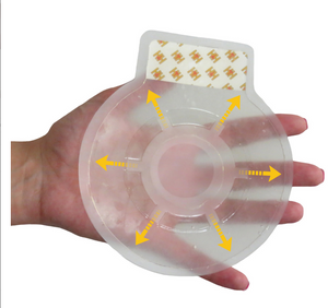 H*VENT Vented Chest Seals