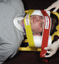 Load image into Gallery viewer, I-Tec Multi-Grip Head Immobilizer