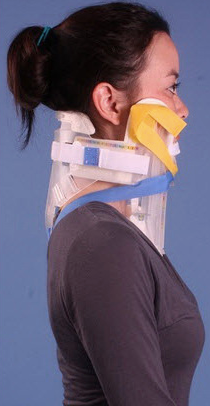 XCollar Cervical Splint, Clear